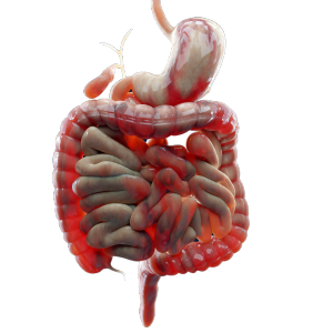 Doença de Crohn - a inflamação crônica do trato gastrointestinal