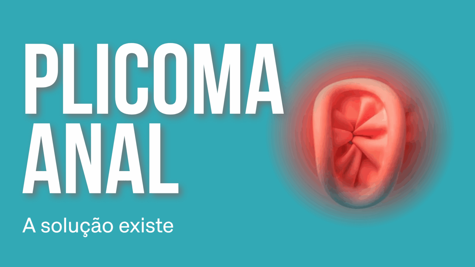 Plicoma Anal: o que é, causas, sintomas e tratamento 1 capa plicoma anal 2 Plicoma Anal: o que é, causas, sintomas e tratamento