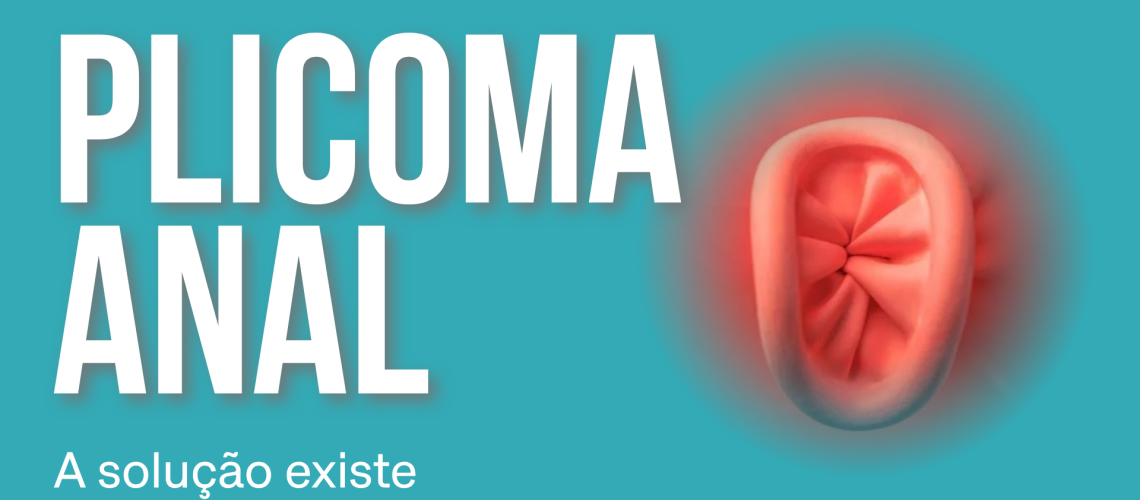 capa plicoma anal capa plicoma anal